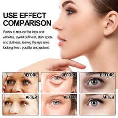 2pcs 20g Eye Lifting Cream for Fine Lines Dark Circles