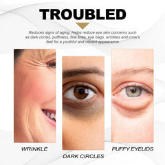 2pcs 20g Eye Lifting Cream for Fine Lines Dark Circles