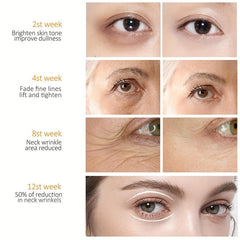 Natural Eye Cream for Dark Circles and Puffiness