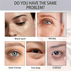 Spot Removal Lifting Eye Gel Hydrating Fade Fine Lines Eye Cream