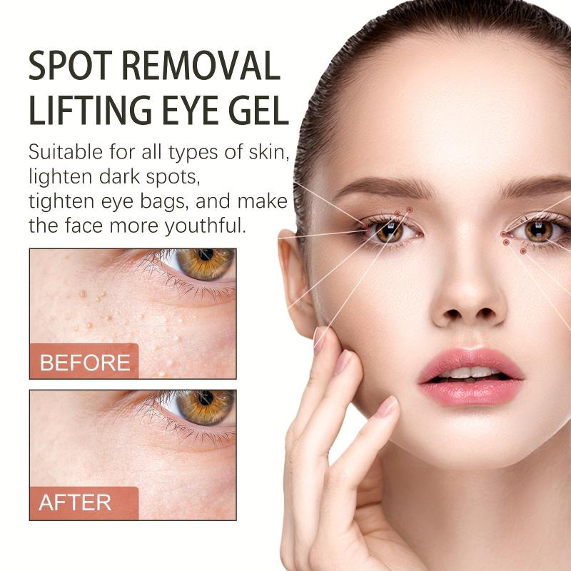 Spot Removal Lifting Eye Gel Hydrating Fade Fine Lines Eye Cream