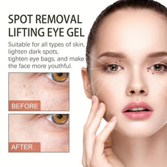 Spot Removal Lifting Eye Gel Hydrating Fade Fine Lines Eye Cream