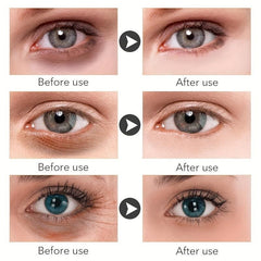 Eye Cream Smooth Wrinkles Reduce Dark Circles Improve Elasticity