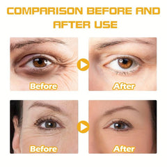 Hyaluronic Acid Eye Cream 30ml Fades Dark Circles Crow's Feet