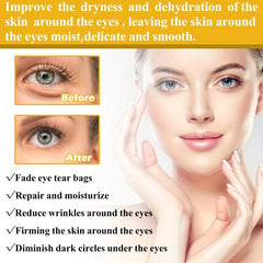 Hyaluronic Acid Eye Cream 30ml Fades Dark Circles Crow's Feet