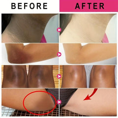 Vitamin C Body Moisturizer for Hydration and Smooth Skin
