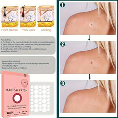 Acne Patch Invisible Spot Cover Hydrocolloid - Facial Spot Stickers