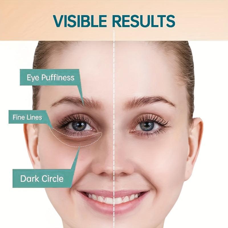 Wrinkle-Reducing Eye Cream for Dark Circles & Puffiness