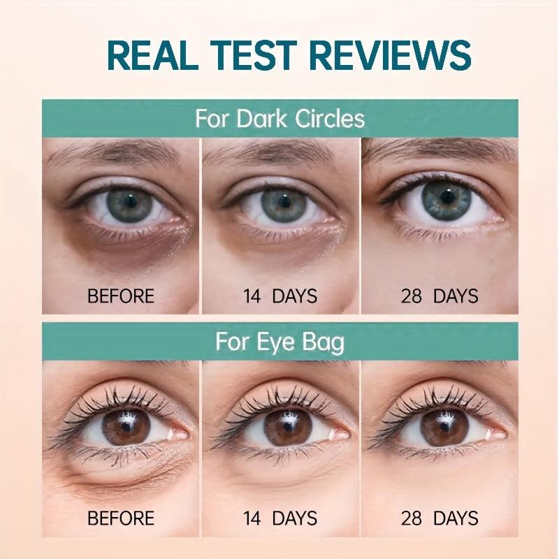 Wrinkle-Reducing Eye Cream for Dark Circles & Puffiness