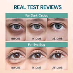 Wrinkle-Reducing Eye Cream for Dark Circles & Puffiness