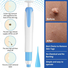 Double Headed Wart Tag Cleaning Tool Skin Care Remover