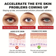 Dark Circle & Puffiness Eye Cream Anti-Aging Wrinkle Remover