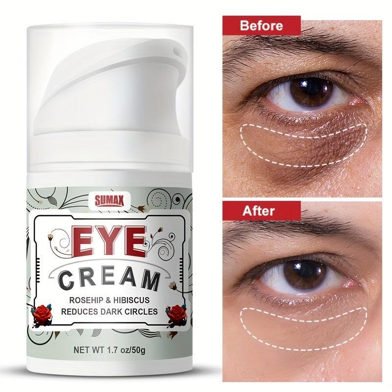 Dark Circle & Puffiness Eye Cream Anti-Aging Wrinkle Remover