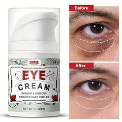Dark Circle & Puffiness Eye Cream Anti-Aging Wrinkle Remover