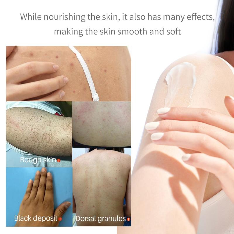 Turmeric Body Lotion Dark Spot Acne Care Fast Results