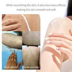 Turmeric Body Lotion Dark Spot Acne Care Fast Results