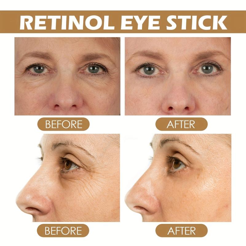 Retinol Eye Cream Reduces Dark Circles Nourishing Firming