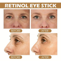 Retinol Eye Cream Reduces Dark Circles Nourishing Firming