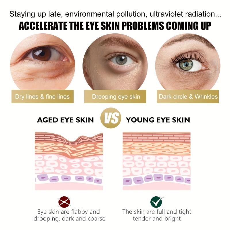 Retinol Eye Cream Reduces Dark Circles Nourishing Firming