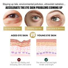 Retinol Eye Cream Reduces Dark Circles Nourishing Firming