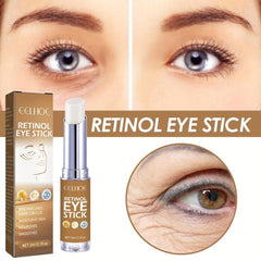 Retinol Eye Cream Reduces Dark Circles Nourishing Firming