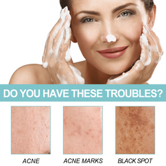 Protein Repair Cleansing Soap for Acne-Prone Skin