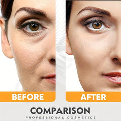 Turmeric Eye Cream Dark Circles Remover Eye Bags With Vitamin C Eye Cream