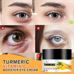 Turmeric Eye Cream Dark Circles Remover Eye Bags With Vitamin C Eye Cream
