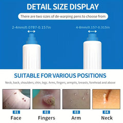 Auto Skin Tag Remover Kit - Safe and Painless Skin Tag Removal Device