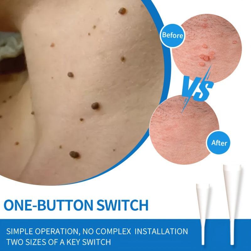 Auto Skin Tag Remover Kit - Safe and Painless Skin Tag Removal Device