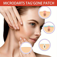 144 Pcs Acne Patch Invisible Skin Repair Acne Pimple Skin Blemish Skin Label