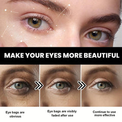 Anti-Aging Eye Cream for Wrinkles, Bags & Dark Circles