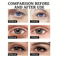 Anti-Aging Eye Cream for Wrinkles, Bags & Dark Circles