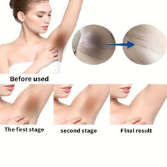 Dark Spot Corrector Cream For Body Face Armpit Knees Elbows Inner Thigh