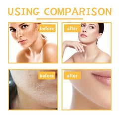 Turmeric Body Scrub Cream - Moisturizing Skin Cleansing Formula
