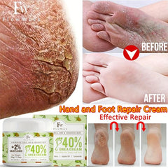 Urea Cream 2% Salicylic Acid 50g Tea Tree Body Lotion Moisturizing Skin Care