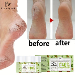 Urea Cream 2% Salicylic Acid 50g Tea Tree Body Lotion Moisturizing Skin Care