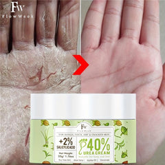 Urea Cream 2% Salicylic Acid 50g Tea Tree Body Lotion Moisturizing Skin Care