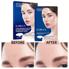 Micro Needle Forehead Patches with Hyaluronic Acid