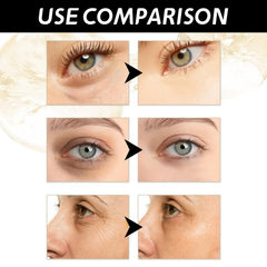 30g Retinol Eye Cream Reduces Dark Circles & Wrinkles