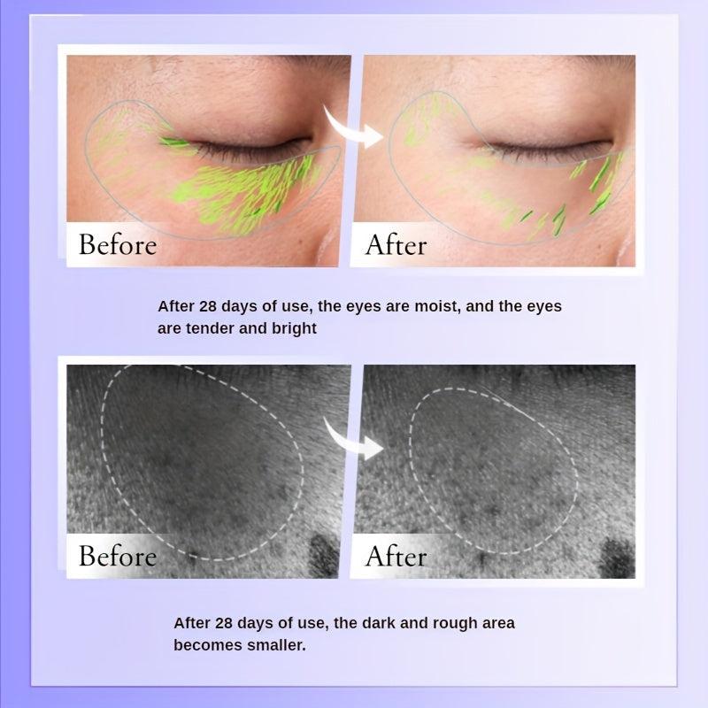 Dark Circle & Eye Bag Cream Anti-Wrinkle Alcohol-Free