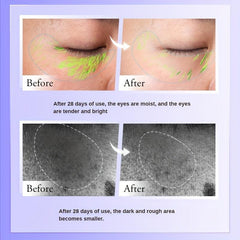 Dark Circle & Eye Bag Cream Anti-Wrinkle Alcohol-Free