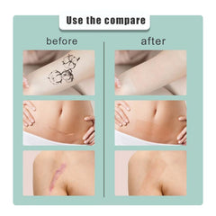 Skin Concealer Sticker Scar Tattoo Acne Cover Waterproof Sticker
