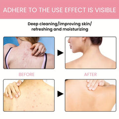 Fruit Acid Body Lotion for Women - Hydrating and Nourishing