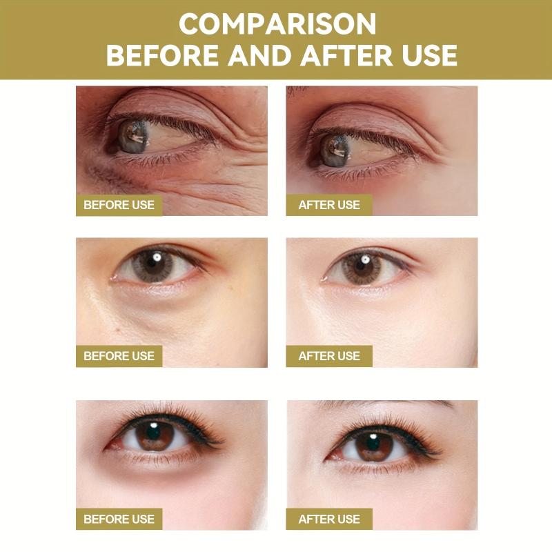Moisturizing Eye Patches for Dark Circles & Bags