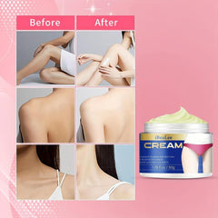 Dark Spot Remover Cream for Body Underarms Armpit Knees Elbows Inner Thigh