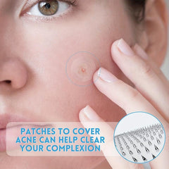 Micro Needles Acne Pimple Patches with Hyaluronic Acid & Salicylic Acid