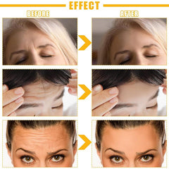 10Pcs Forehead Wrinkle Patches with Collagen for Women
