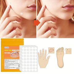 Skin Tag Acne Pimple Patch Blemish Spot Facial Mask Skin Care 120pcs