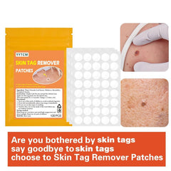 Skin Tag Acne Pimple Patch Blemish Spot Facial Mask Skin Care 120pcs